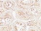 MIB1 Polyclonal Antibody